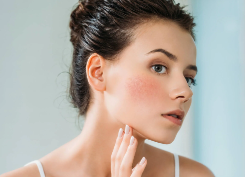 Sensitive Skin
