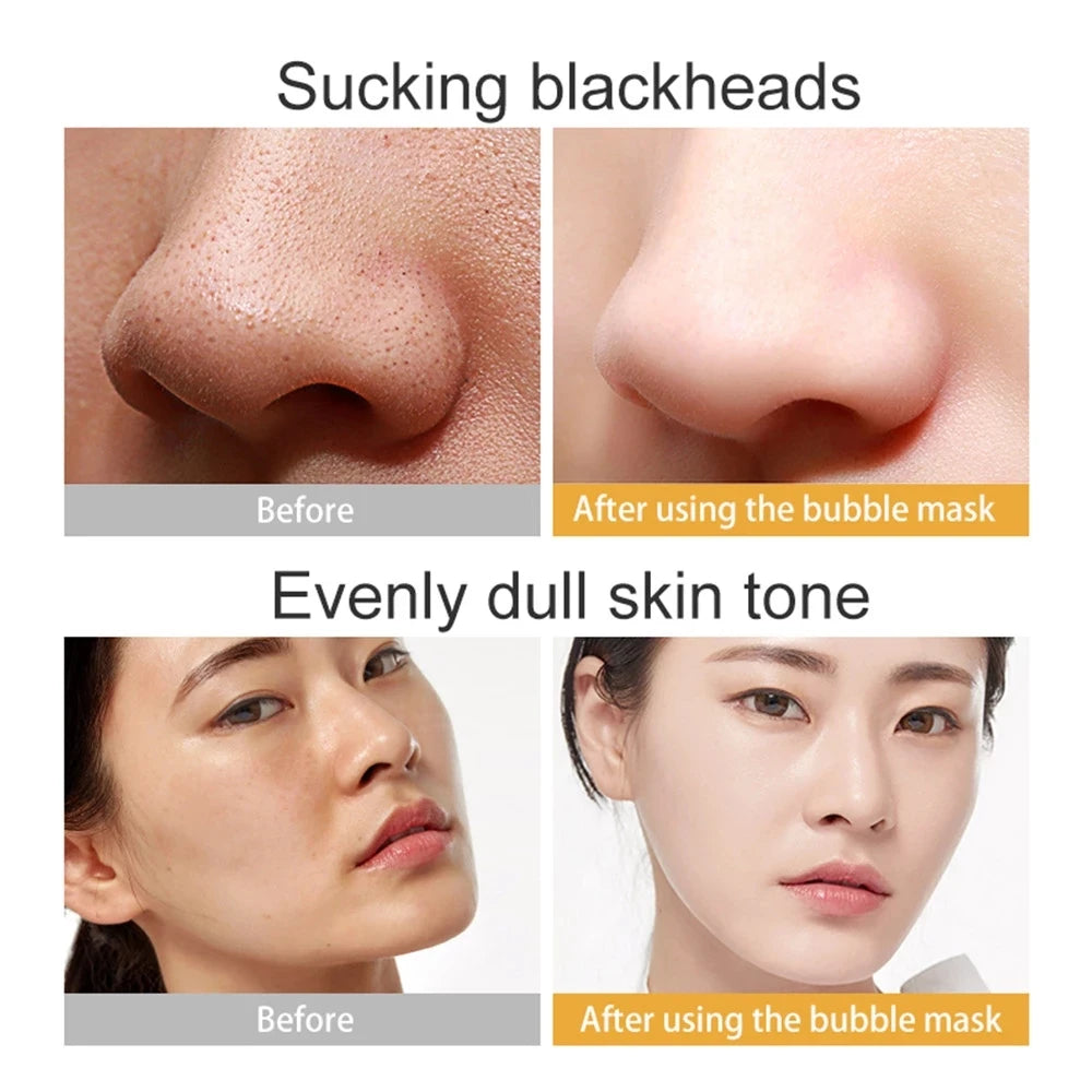 1pc Black Sea Salt Pure Moisturizing Bubble Facial Mask Deep Cleansing Oil Control Skin Rejuvenation Shrink Pore Foam Black Mask