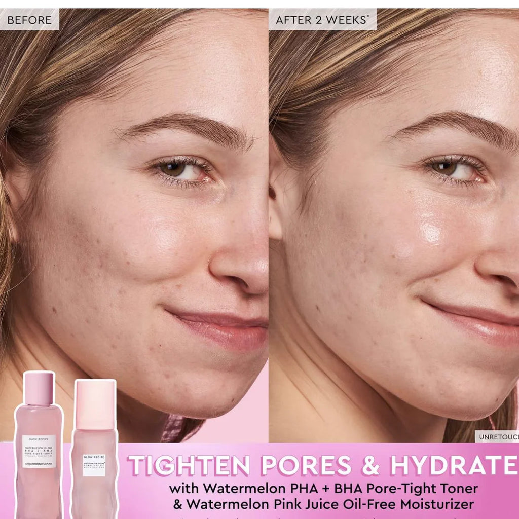 150ml WATERMELON Brighteing Face Toner