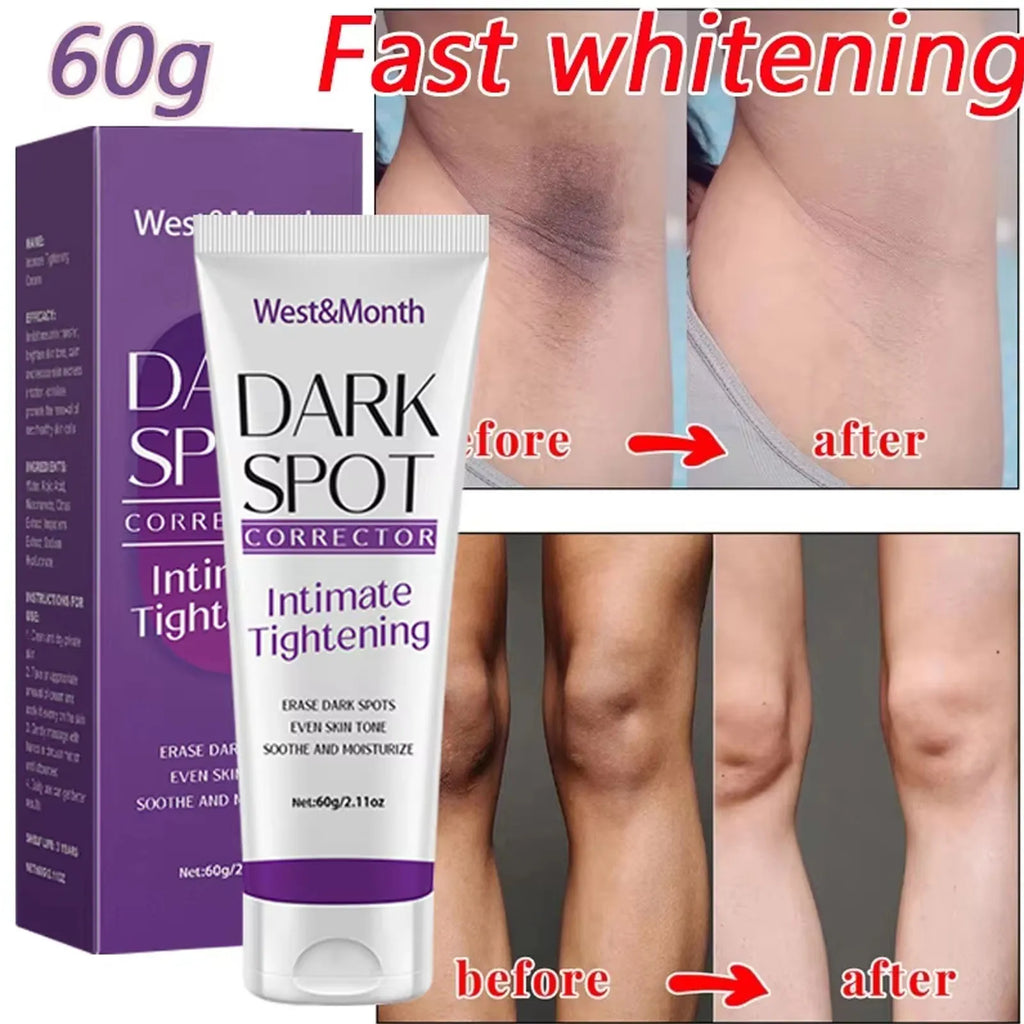 Body Whitening Lotion Dark Spot Remover For Underarms Knees Elbows