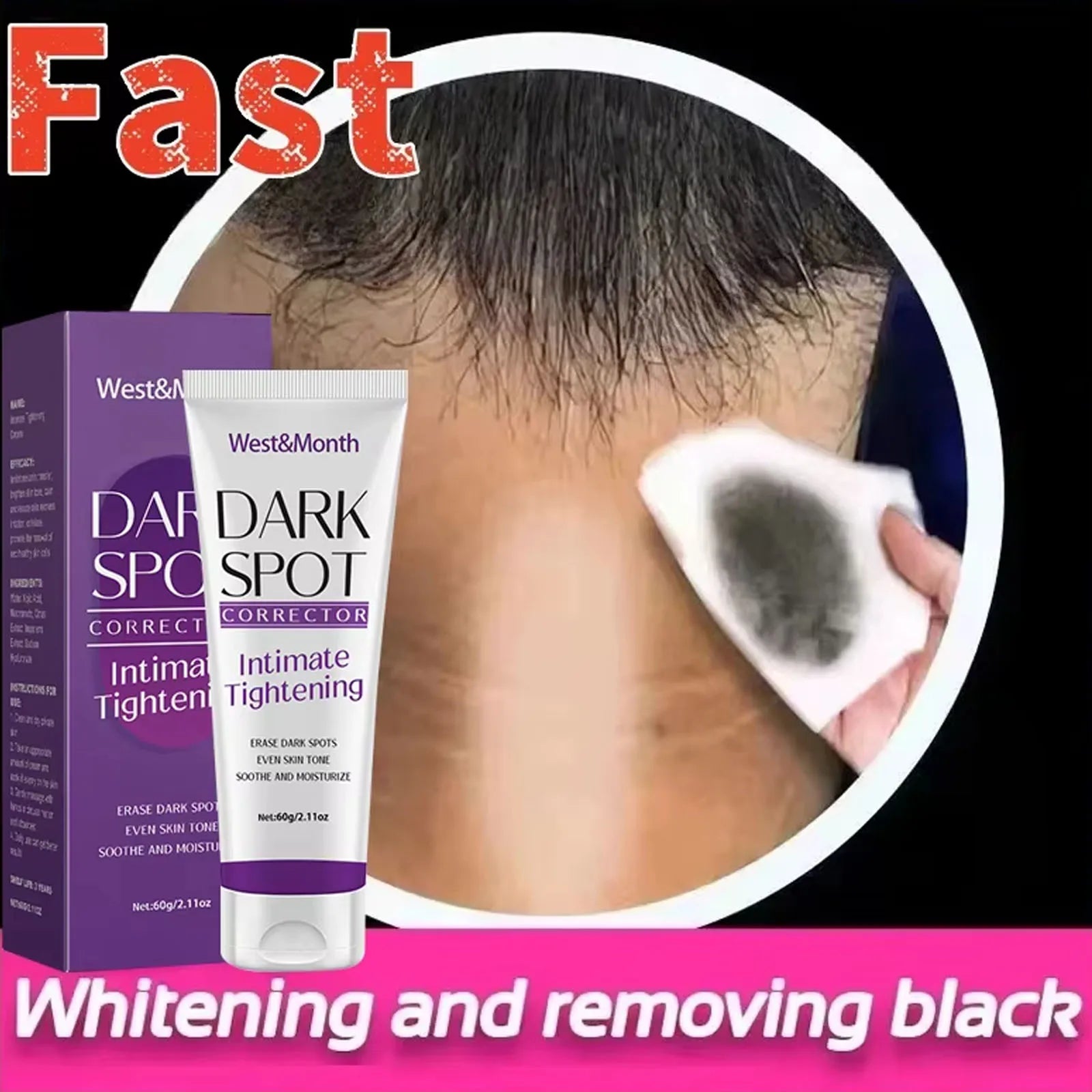 Body Whitening Lotion Dark Spot Remover For Underarms Knees Elbows