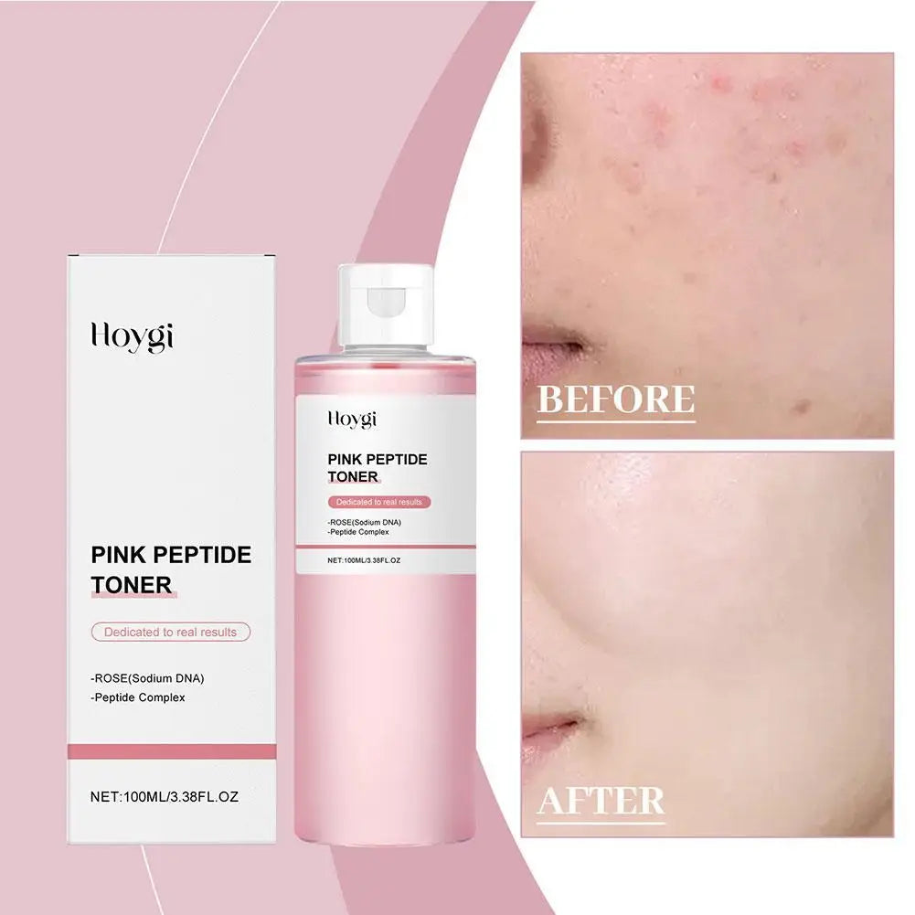 Peptide Niacinamide Korean Skin Care Salmon DNA PDRN Pink CICA Soothing Toner