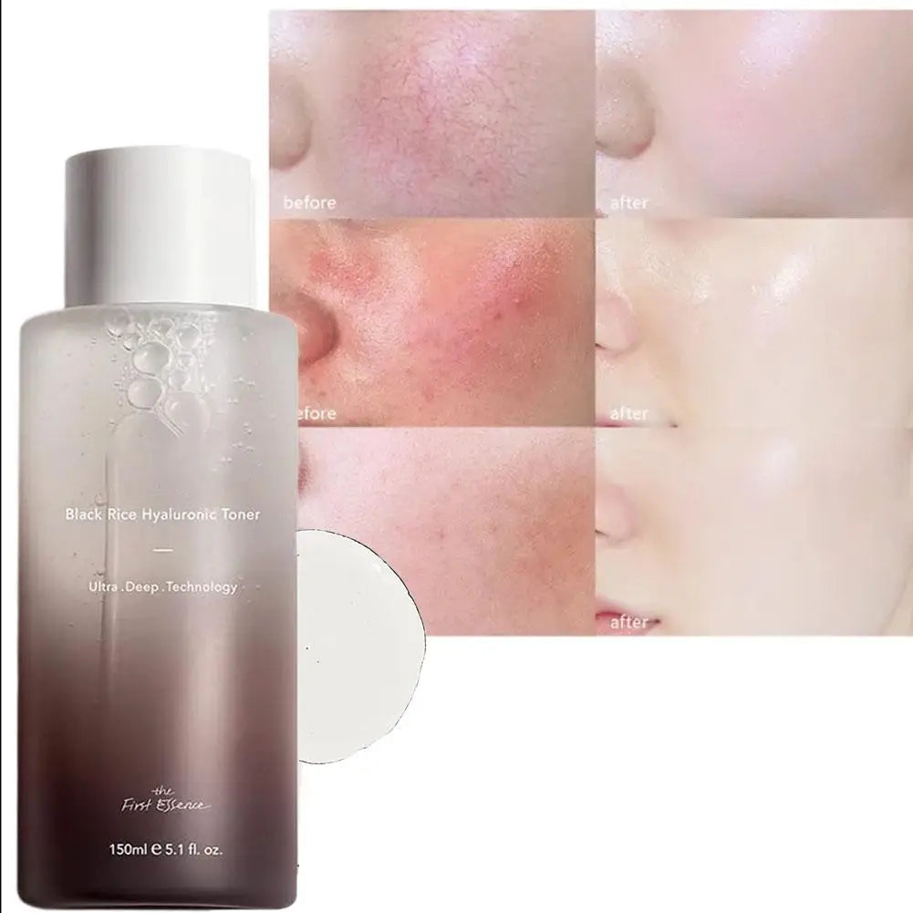 Haruharu Wonder Black Rice Toner