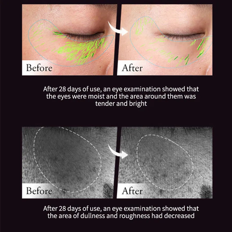 30g Retinol Eye Cream Centella Asiatica Extract Drying Hydrating Hyaluronic Acid Refreshing Eye Serum Fades Fine Line Firming