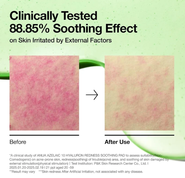 Anua Azelaic Acid 10 Hyaluron Redness Soothing Pad 90 pads