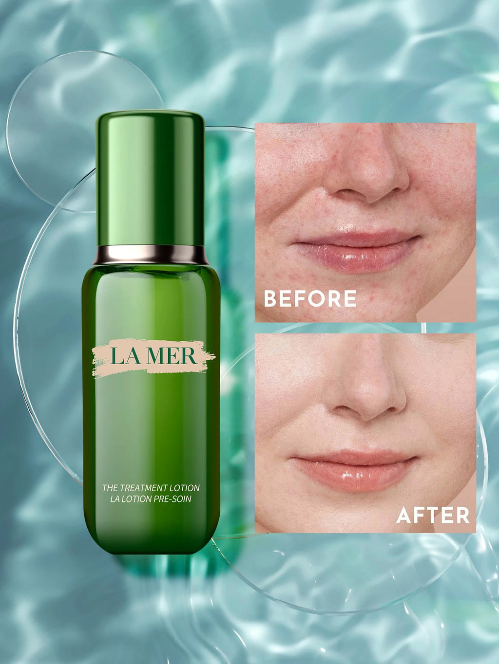 La Mer The Treatment Lotion-Revitalizing Hydrating Serum 5 fl. oz.liq./150ml