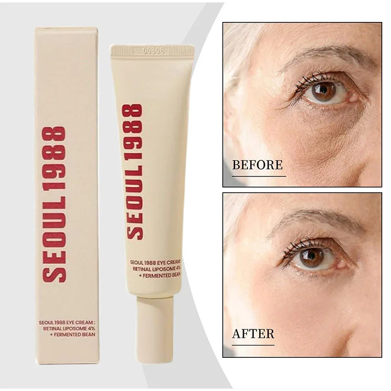 SEOUL 1988 Retinol Eye Cream 4% Anti Aging Eye for Dark Circles Wrinkles Puffiness Firming & Lifting Korean Eye Cream Women 30ml